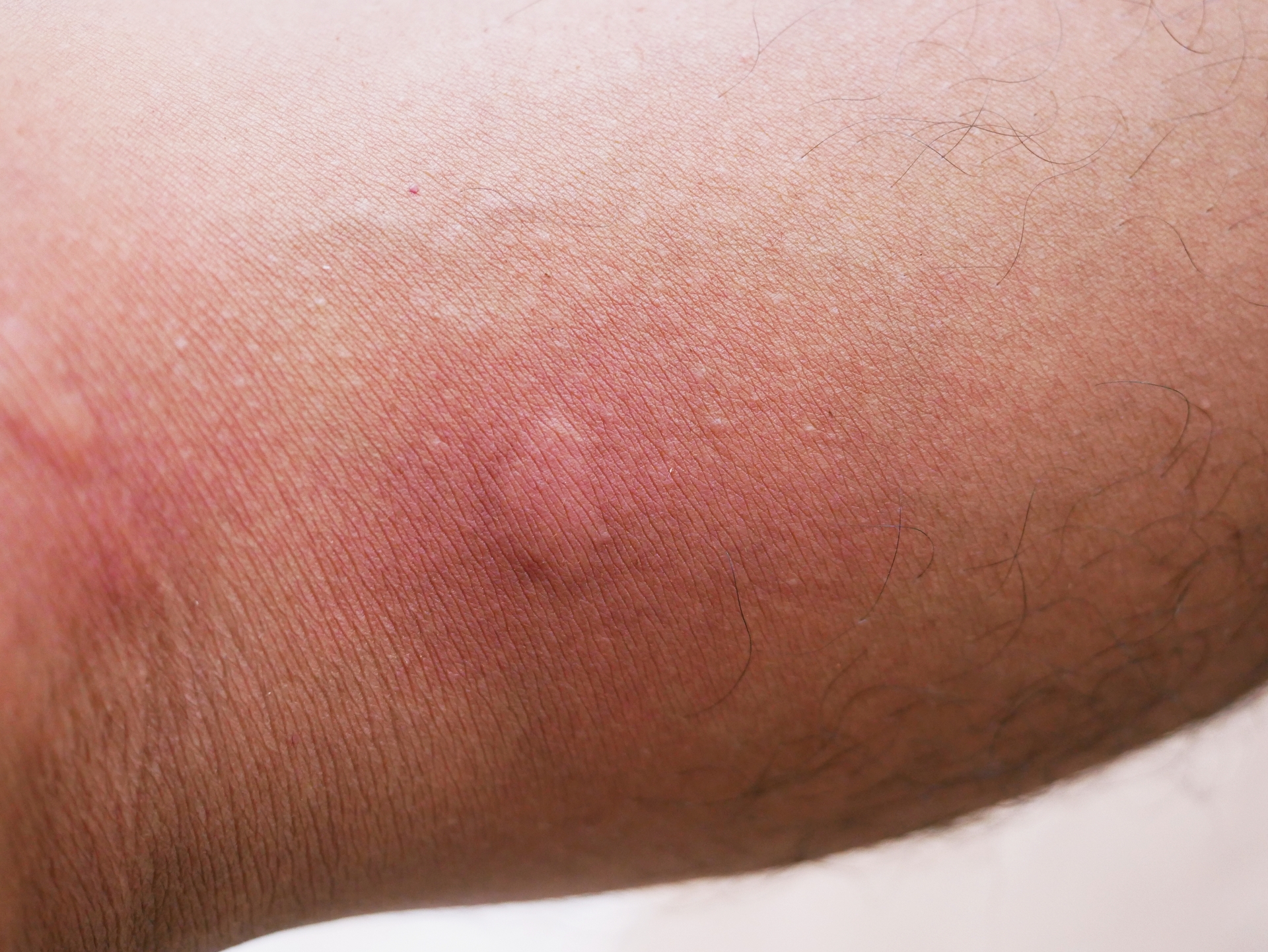 Common signs of bed bugs in a home requiring professional inspection
